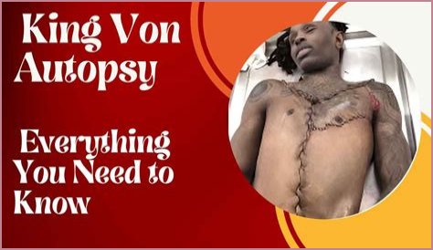 King Von Autopsy Photo: An Insight Into The Life And Legacy Of A Rising Star